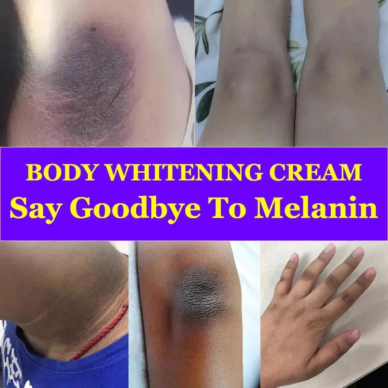 Whitening Cream Private Parts Underarm Bleaching Serum Whiten Butt Knee Brighten Inner Thigh Intimate Parts Dark Remove Melanin